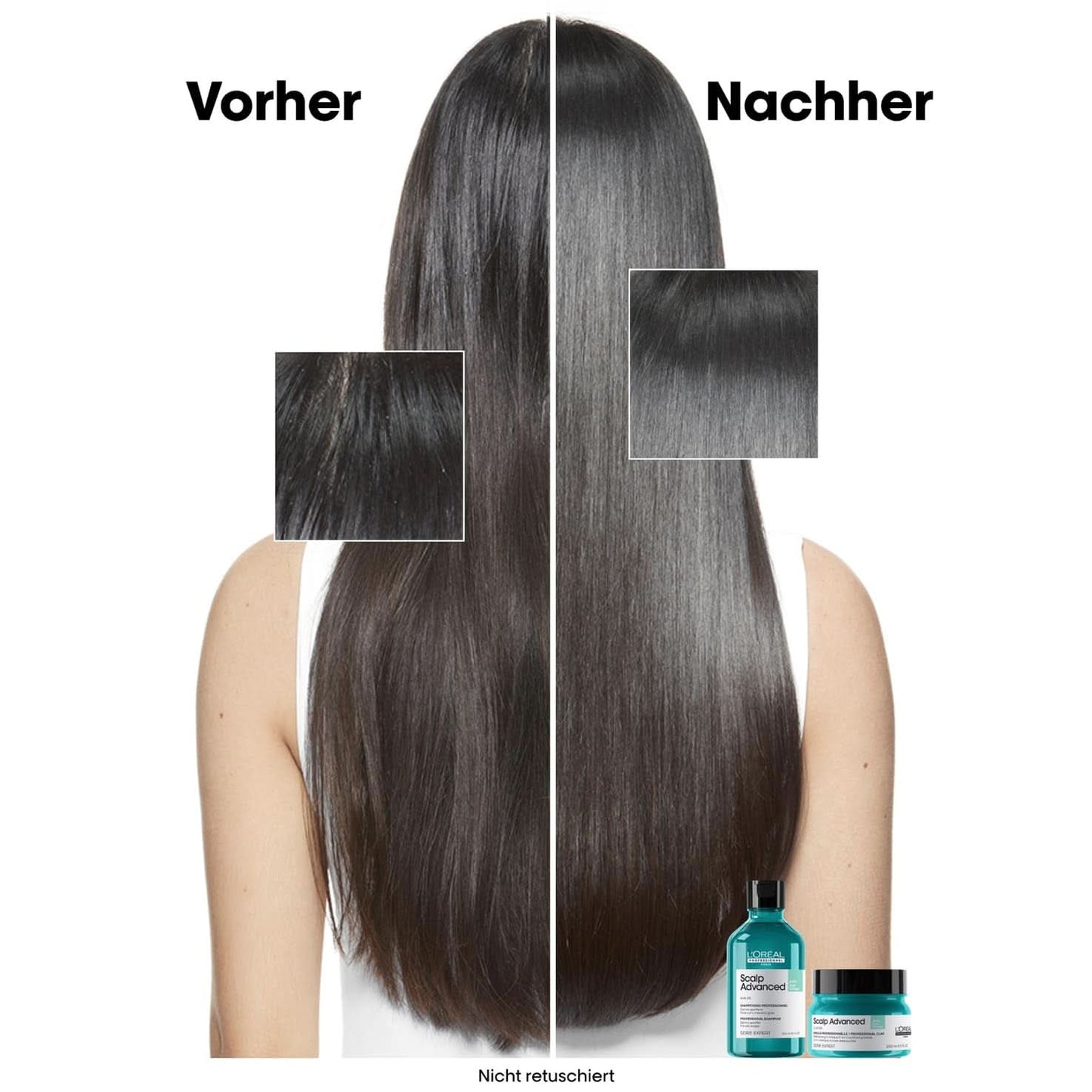 L'Oréal Professionnel Shampoing Nettoyant Cuir Chevelu Gras, 300 ml Naty Shop Douche et Bain