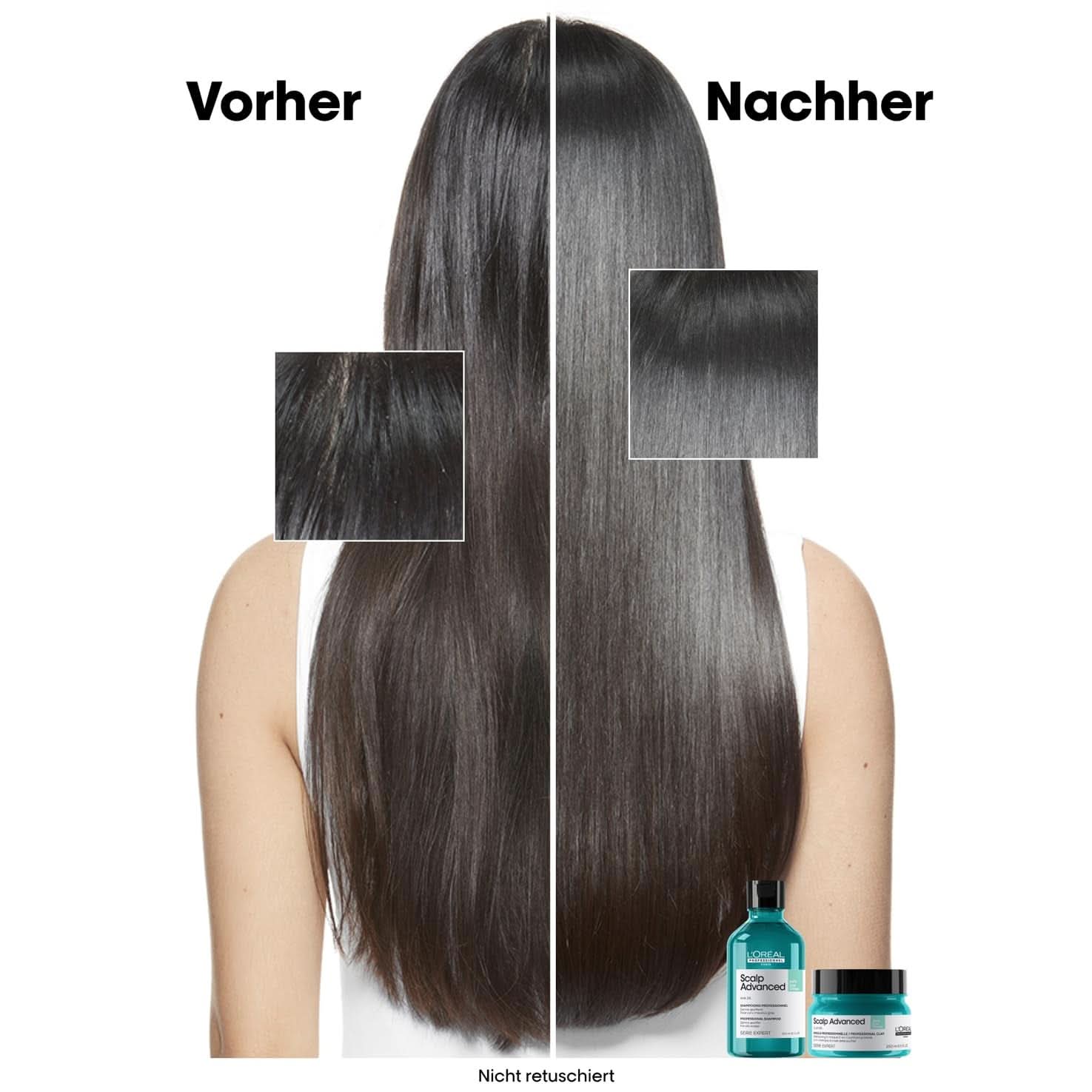 L'Oréal Professionnel Shampoing Nettoyant Cuir Chevelu Gras, 300 ml Naty Shop Douche et Bain