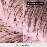 L'Oréal Professionnel Shampoing Nettoyant Cuir Chevelu Gras, 300 ml Naty Shop Douche et Bain