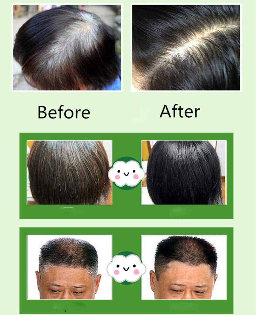 Ingrédients naturels Shampoing instantané pour teinture capillaire noire, teinture semi-permanente pour cheveux noirs, facile à utiliser, longue durée, ingrédients naturels (10 pièces, noir) Naty Shop Hair Dye