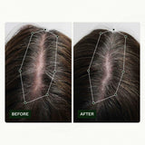 Routine de croissance des cheveux de Norwegian Biolabs pour les femmes avec des résultats cliniquement prouvés en 45 jours | Traitement contre la chute des cheveux (Bio-Pilixin) Naty Shop Soins Capillaires
