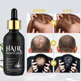 Huile de Croissance Capillaire Bio 5% - Solution Usage Externe - Croissance et Épaississement des Cheveux - Pour Chute de Cheveux Masculine et Cheveux Clairsemés - Réactive les Follicules Rétrécissants - Distributeur à Pompe Précis, 60ml Soin Capillaire Naty Shop