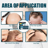 Miioto Sérum de Croissance des Cheveux Hommes Produit de Croissance des Cheveux Sérum de Croissance des Cheveux Soins du Cuir Chevelu Promouvoir des Cheveux Plus Épais Nourrir le Cuir Chevelu Prévenir la Perte de Cheveux 3*60ML Soins des Cheveux Naty Shop