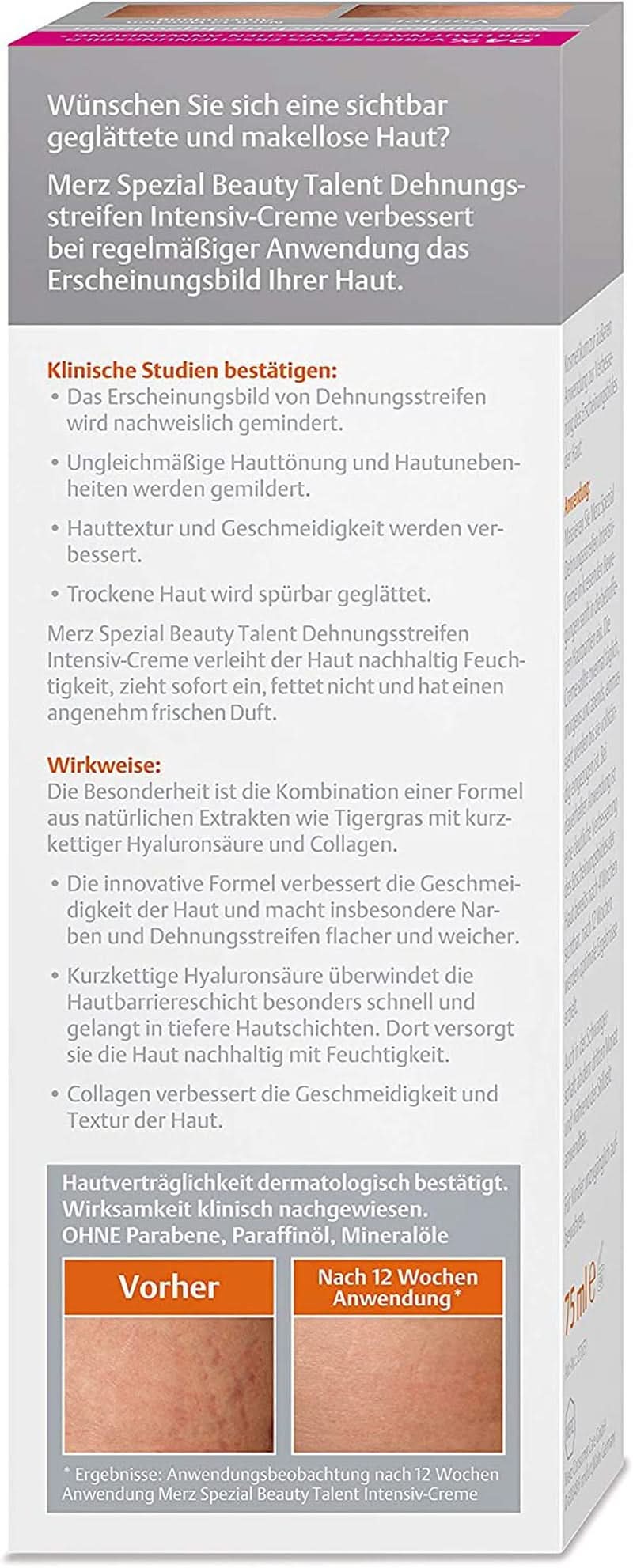 Merz Spezial, Crème intensive contre les vergetures, 75 ml Cosmétiques et Beauté Naty Shop